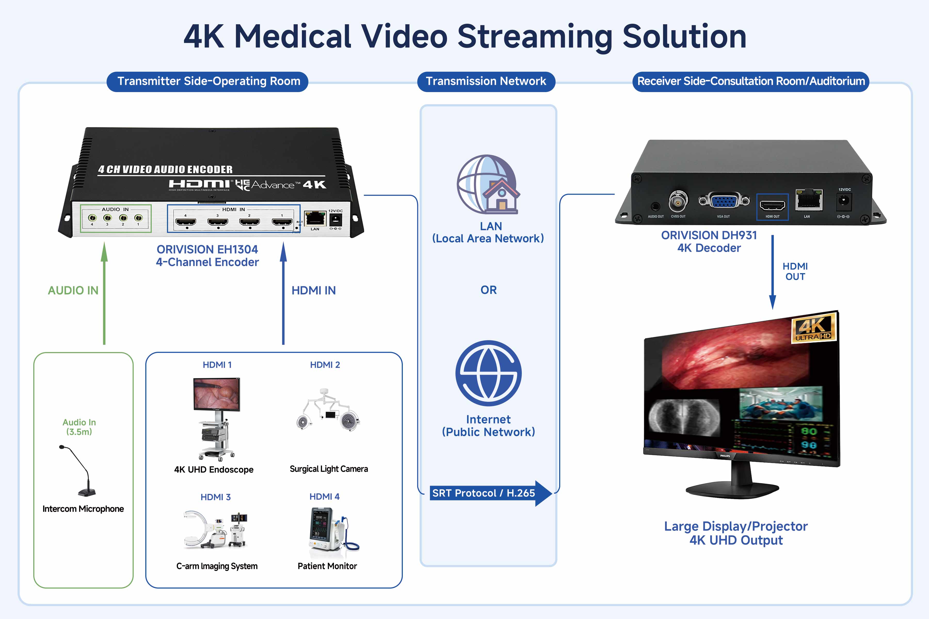 Low latency 4K telemedicine streaming via SRT protocol